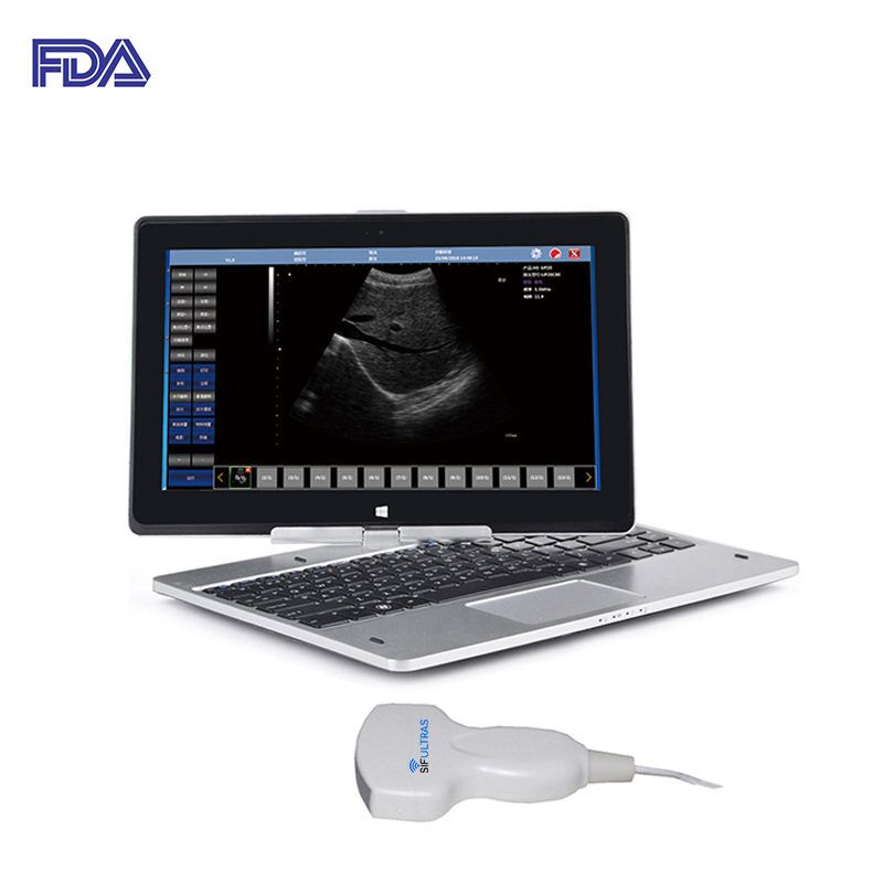 Laptop Ultrasound Scanner: SIFULTRAS-9.1, FDA  main pic