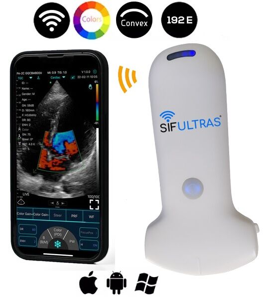 handheld portable ultrasound scanner