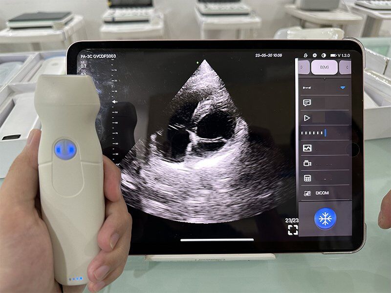 phased array cardiac doppler ultrasound machine