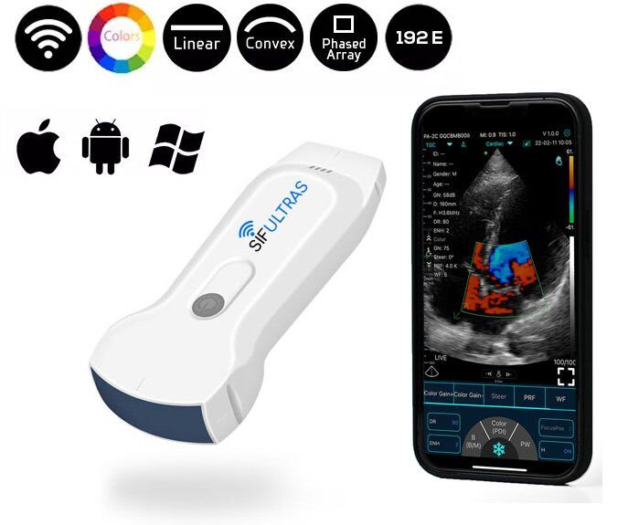 portable Handheld Ultrasound Machine