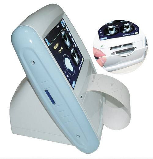 Scanner à ultrasons de la vessie à balayage 3D SIFULTRAS-5.51 main