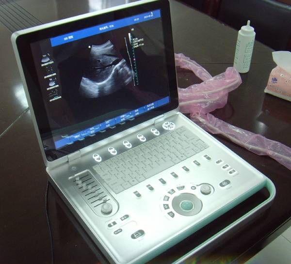 SIFULTRAS-6.2 แล็ปท็อป Echocardiography Color Doppler Ultrasound Scanner หลัก