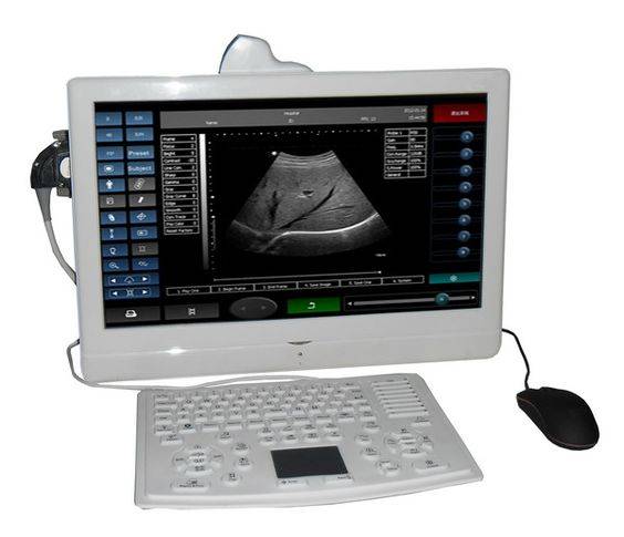 SIFULTRAS-4.1 Portable Wireless Schwangerschaft Ultraschall Scanner Haaptsäit