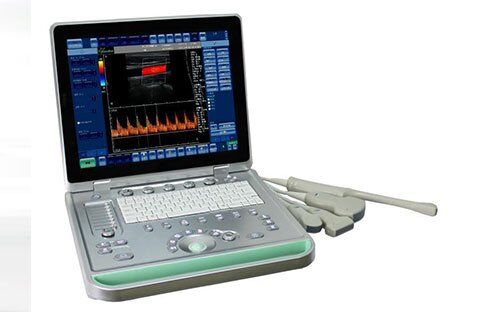 Scanner d'échographie de grossesse Doppler couleur SIFULTRAS-6.1 main