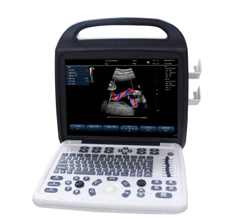 scanner de ultrassom portátil
