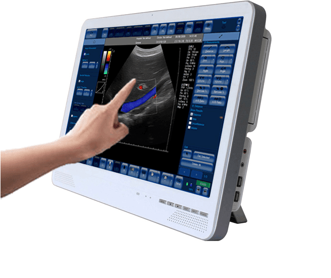 SIFULTRAS-7.1 Portátil Color Doppler Ultrasound Scanner PW principal