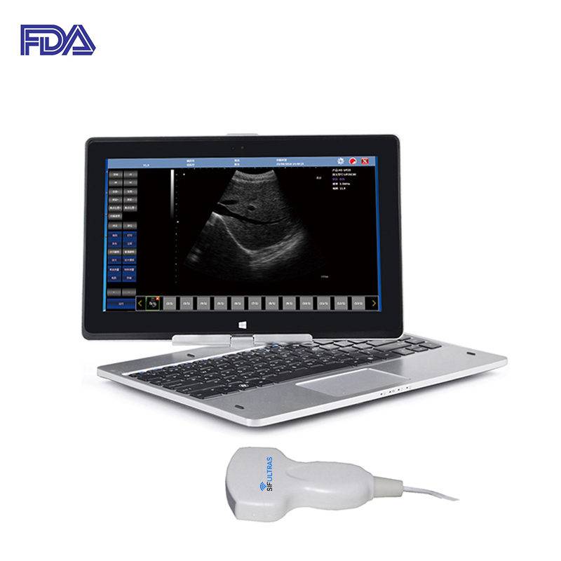 Laptop Ultraschall Scanner: SIFULTRAS-9.1, FDA Main Pic