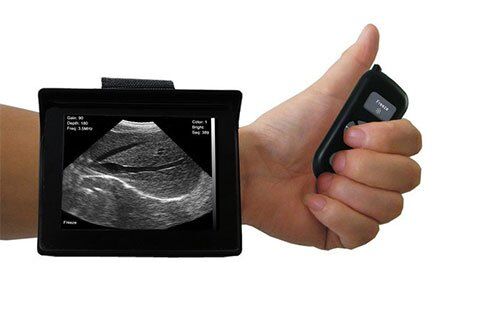 Scanner à ultrasons portatif vétérinaire 3.5-5MHz SIFULTRAS-4.3 main