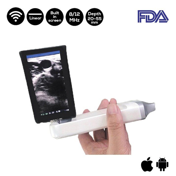 Escáner de ultrasonido lineal de pantalla incorporada SIFULTRAS-5.4 FDA principal
