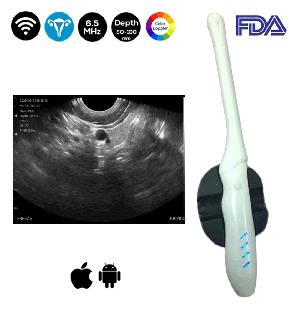 Scanner de ultrassom transvaginal sem fio Doppler colorido FDA SIFULTRAS-6.36