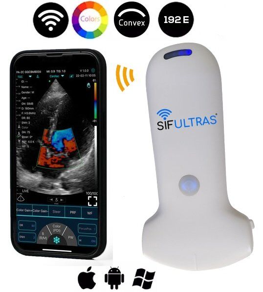 scanner de ultrassom portátil portátil