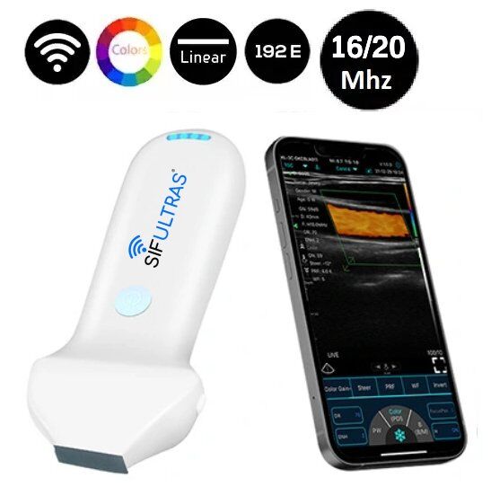 mesin ultrasound mudah alih pegang tangan